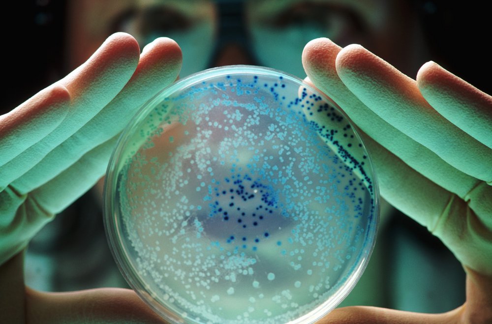 Bakterie Escherichia coli, seznamte se.
