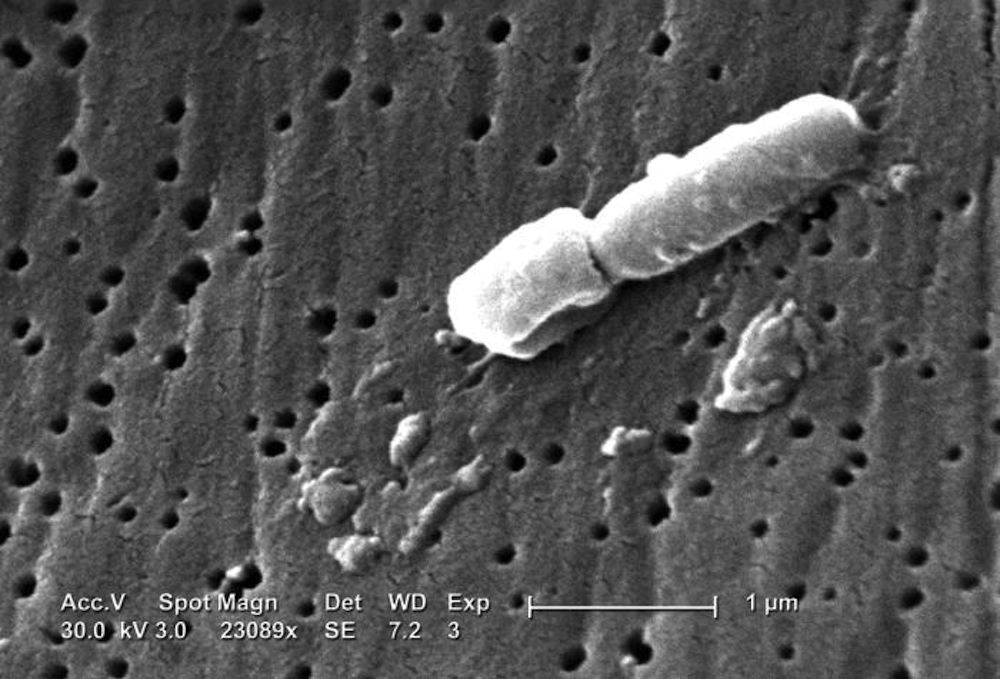 Není lehké se jí zbavit. (Rezistentní bakterie Klebsiella pneumoniae)