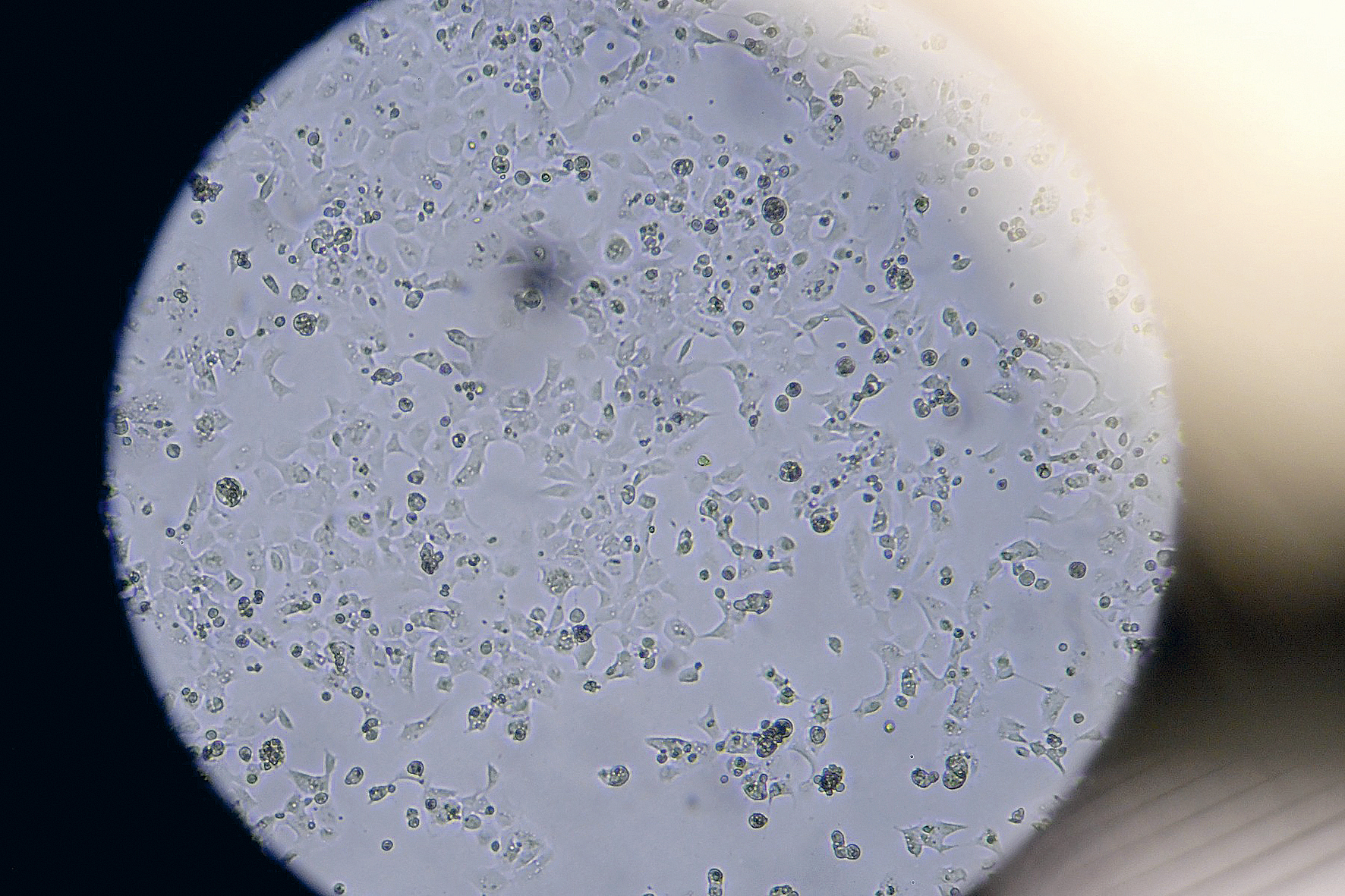 Mladý a při chuti. (Koronavirus v buněčné kultuře)
