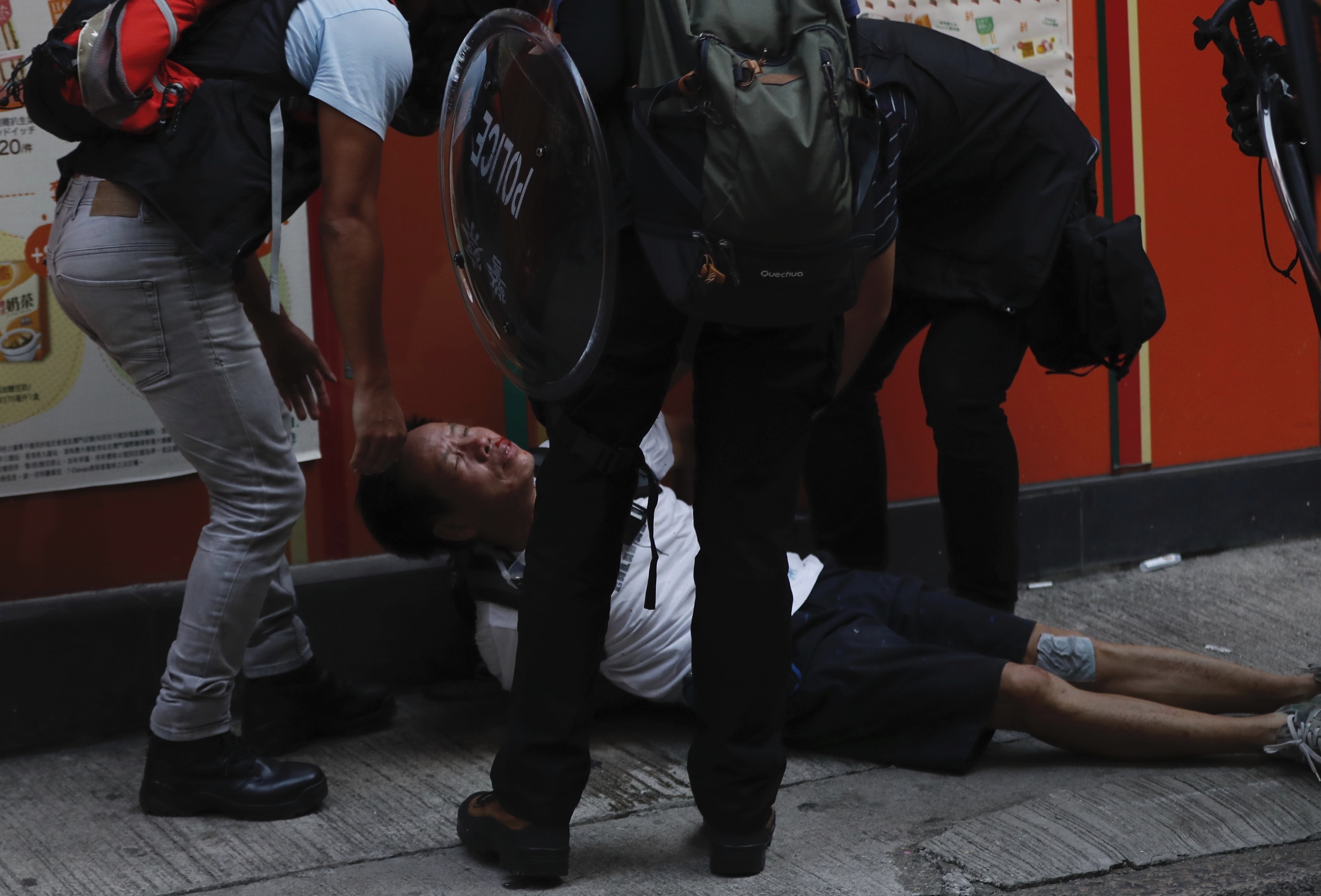 Zraněný protivládní demonstrant  v Hongkongu