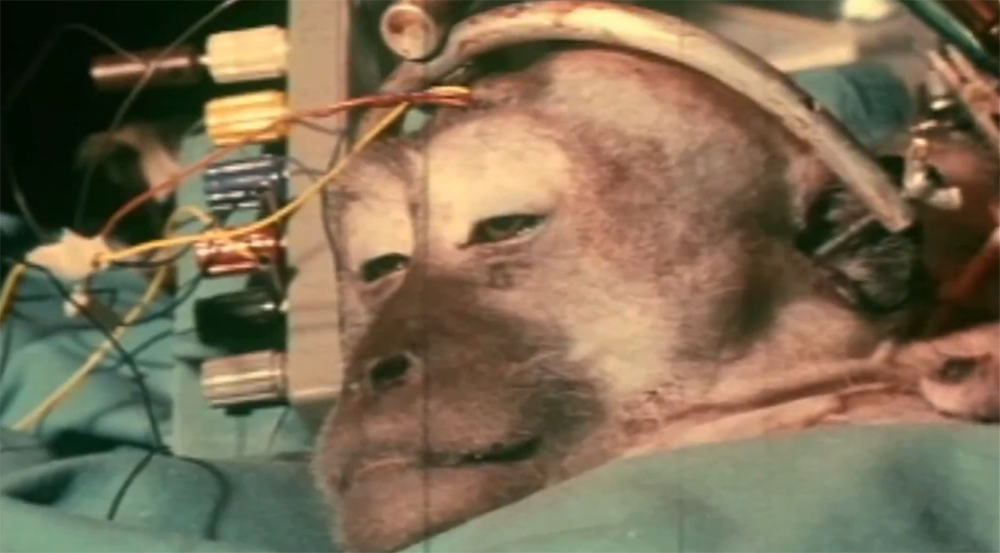 Monkey Brain Transplant