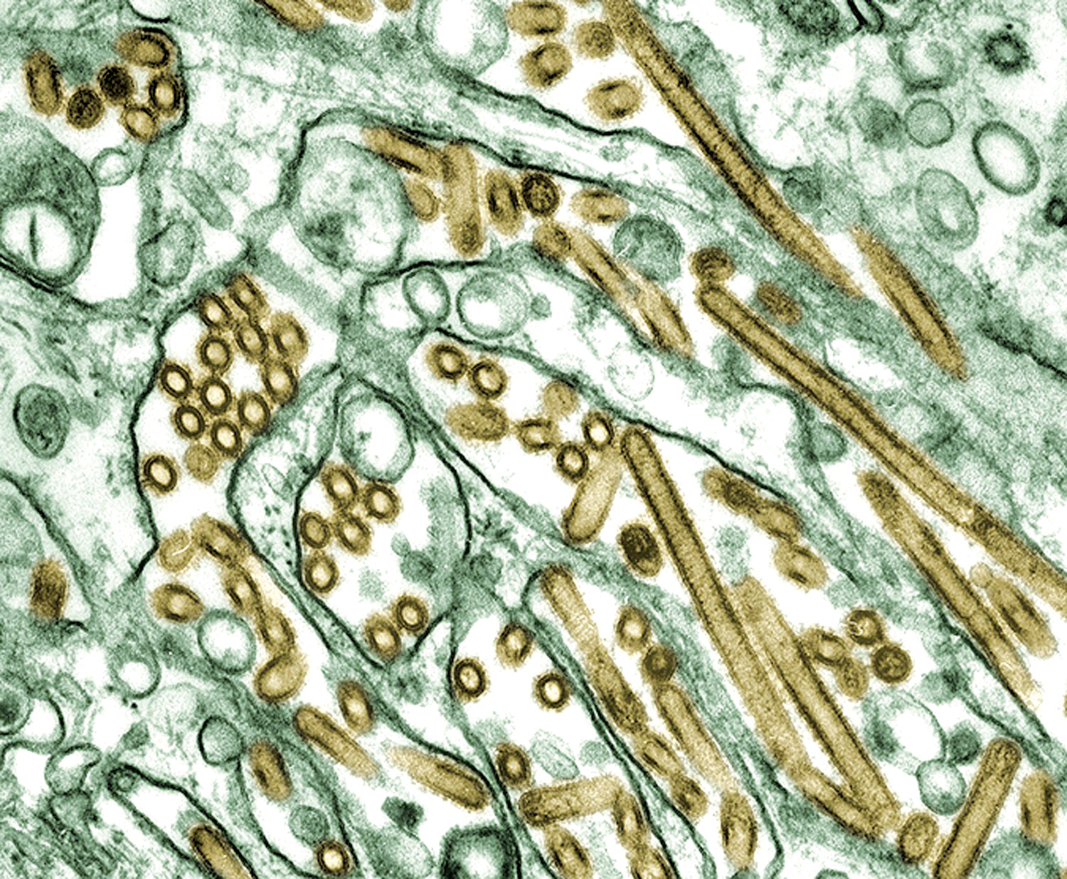 Virus ptačí chřipky H5N1 (zlatou barvou) v buněčné kultuře